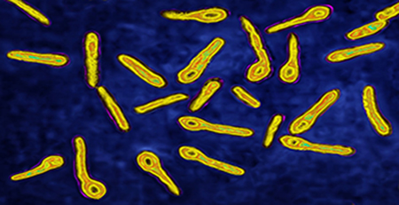 破傷風(fēng)桿菌